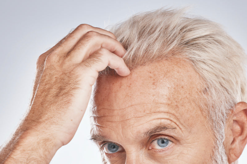 Die Bedeutung von Thiocyanat und sein Effekt auf die Haarfollikel Die Bedeutung von Thiocyanat und sein Effekt auf die Haarfollikel