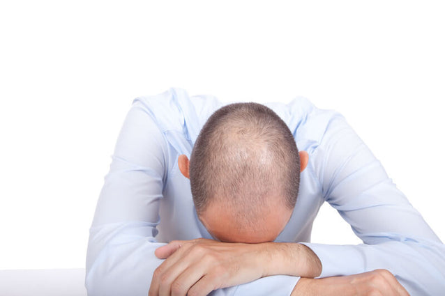 Perte de cheveux avec 20 Perte de cheveux avec 20