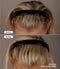 Vorher-Nachher-Vergleichsbild einer blonden Frau, nach der 36-wöchigen Anwendung des Thiocyn Haarserums Frauen. Vorher-Nachher-Vergleichsbild einer blonden Frau, nach der 36-wöchigen Anwendung des Thiocyn Haarserums Frauen.