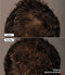 Vorher-Nachher-Vergleichsbild eines braunhaarigen Mannes, nach der 36-wöchigen Anwendung des Thiocyn Haarserums Männer. Vorher-Nachher-Vergleichsbild eines braunhaarigen Mannes, nach der 36-wöchigen Anwendung des Thiocyn Haarserums Männer.
