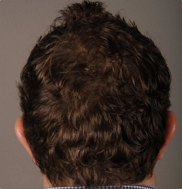 Echtes Haar, echte Ergebnisse Echtes Haar, echte Ergebnisse