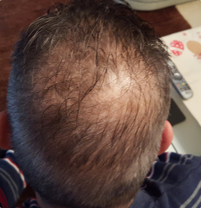 Echtes Haar, echte Ergebnisse Echtes Haar, echte Ergebnisse