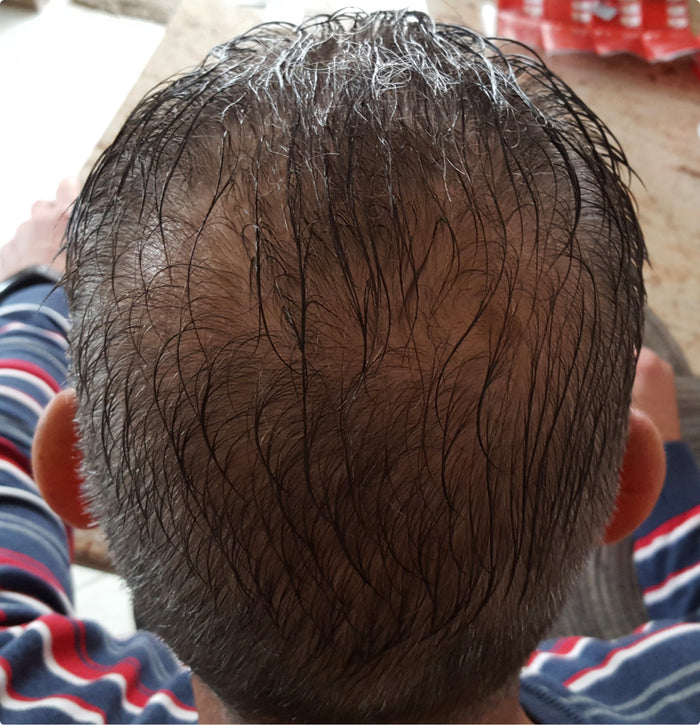 Echtes Haar, echte Ergebnisse Echtes Haar, echte Ergebnisse