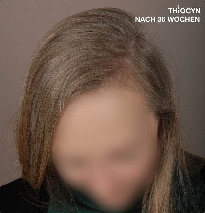 Echtes Haar, echte Ergebnisse Echtes Haar, echte Ergebnisse