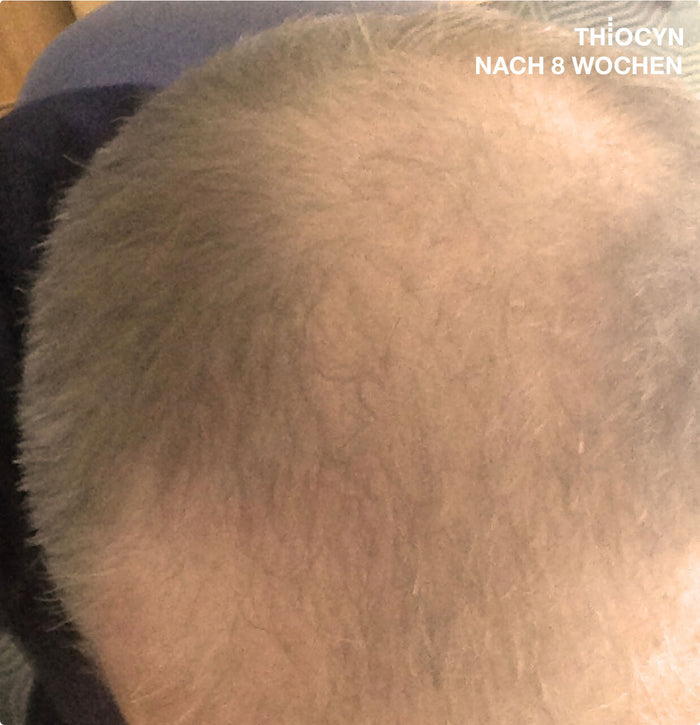Echtes Haar, echte Ergebnisse Echtes Haar, echte Ergebnisse