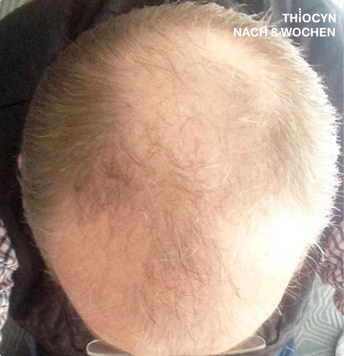 Echtes Haar, echte Ergebnisse Echtes Haar, echte Ergebnisse