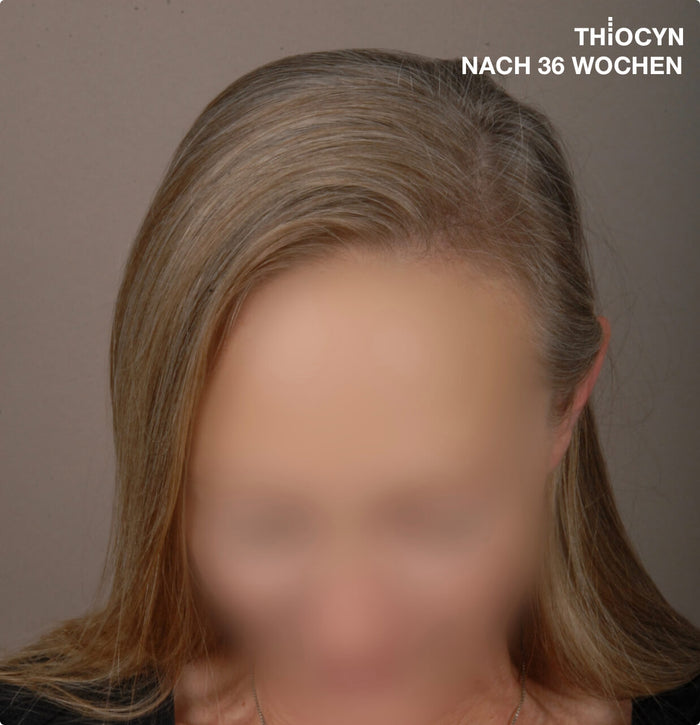Echtes Haar, echte Ergebnisse Echtes Haar, echte Ergebnisse