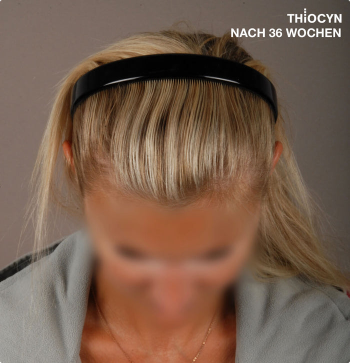 Echtes Haar, echte Ergebnisse Echtes Haar, echte Ergebnisse