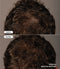 Vorher-Nachher-Vergleichsbild eines braunhaarigen Mannes, nach der 36-wöchigen Anwendung des Thiocyn Haarserums Männer.